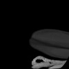 SPORK, NICO - 22.03.1976 - 02.08.2022 - CT obere Extremität - 17:59:38